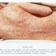 Illustration for article titled Why Adults Are More Likely To Be Hit Hard By The Measles Than Children